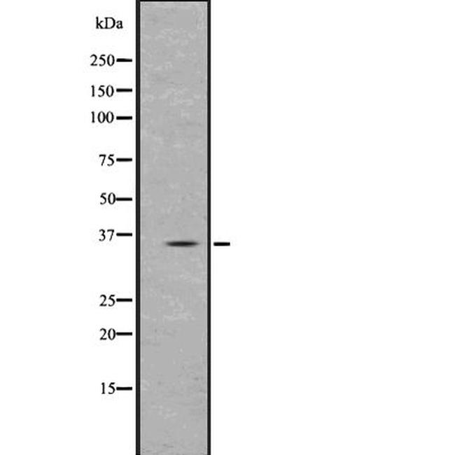 PPT1 Antibody in Western Blot (WB)