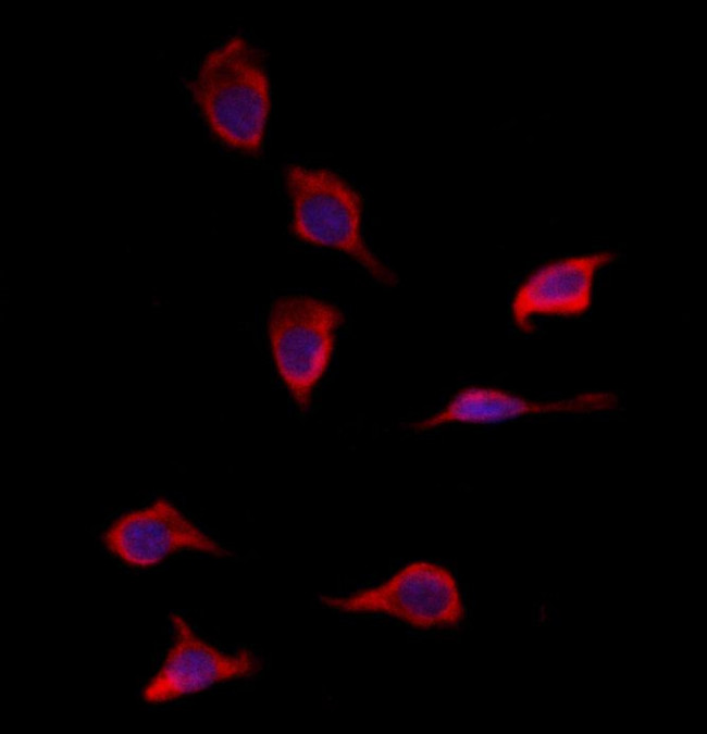 SOD3 Antibody in Immunocytochemistry (ICC/IF)