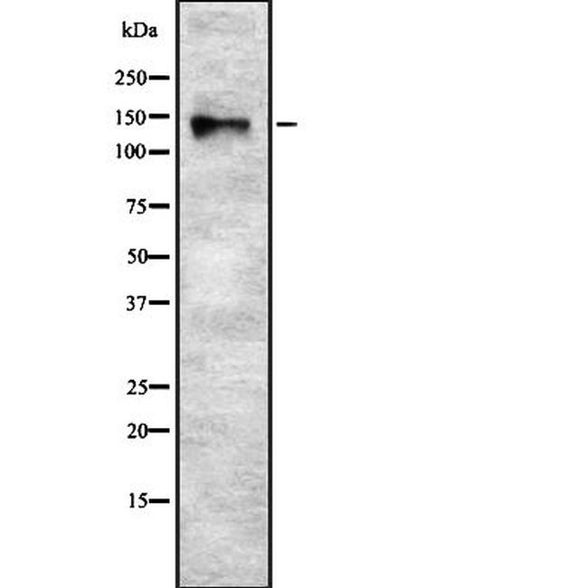 Synaptojanin 2 Antibody in Western Blot (WB)