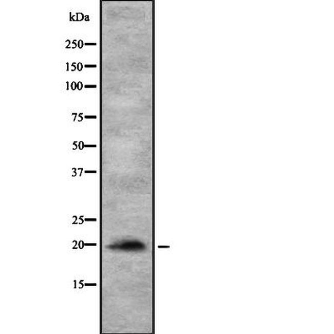 MYL12A Antibody in Western Blot (WB)