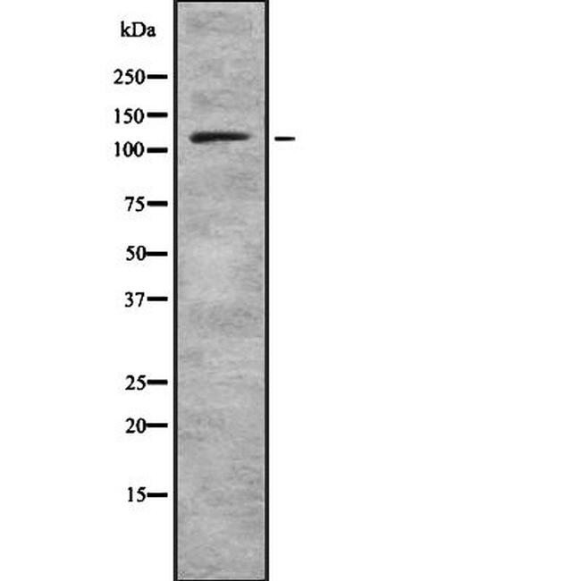 PLD1 Antibody in Western Blot (WB)