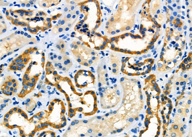 MT-CO2 Antibody in Immunohistochemistry (Paraffin) (IHC (P))