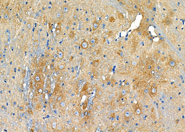 MT-CO2 Antibody in Immunohistochemistry (Paraffin) (IHC (P))