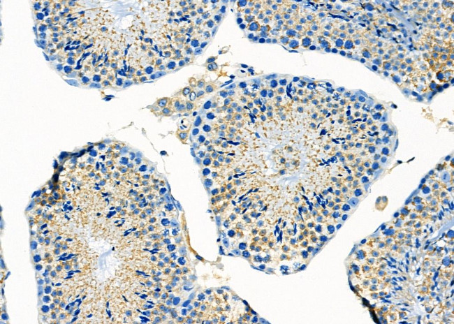 MT-CO2 Antibody in Immunohistochemistry (Paraffin) (IHC (P))