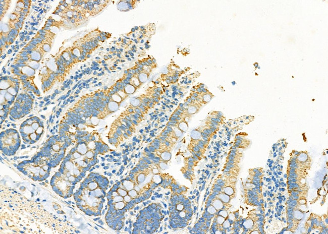 MT-CO2 Antibody in Immunohistochemistry (Paraffin) (IHC (P))