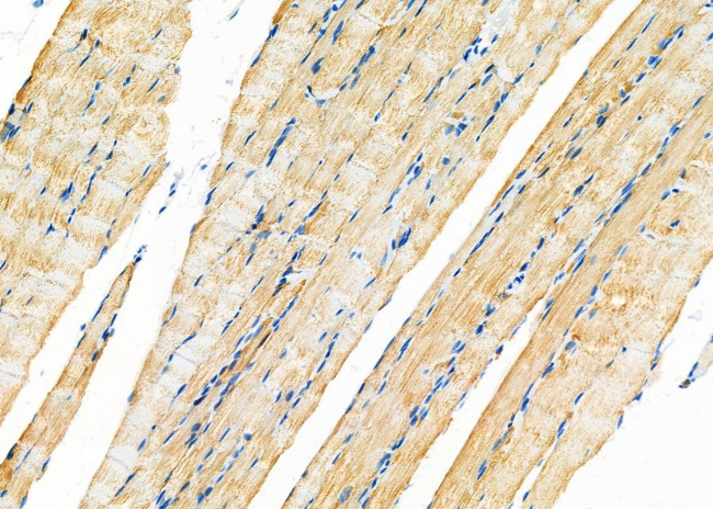 MT-CO2 Antibody in Immunohistochemistry (Paraffin) (IHC (P))