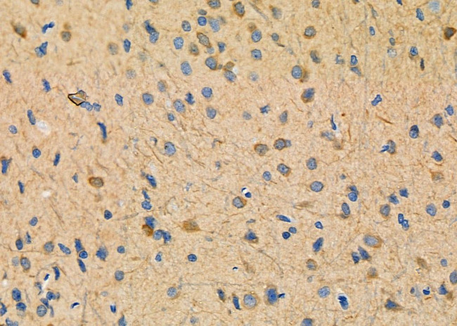 NDUFAF1 Antibody in Immunohistochemistry (Paraffin) (IHC (P))