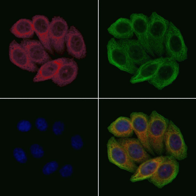 Lysozyme Antibody in Immunocytochemistry (ICC/IF)