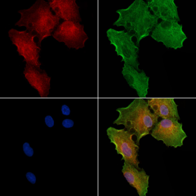 hCG beta-2 Antibody in Immunocytochemistry (ICC/IF)