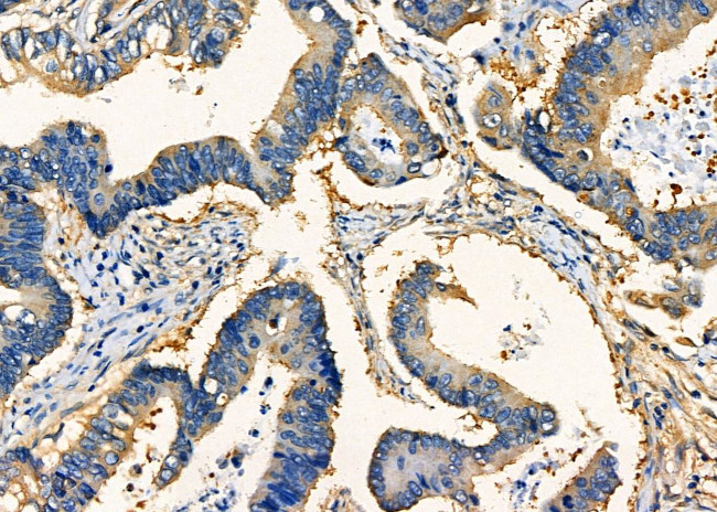 hCG beta-2 Antibody in Immunohistochemistry (Paraffin) (IHC (P))