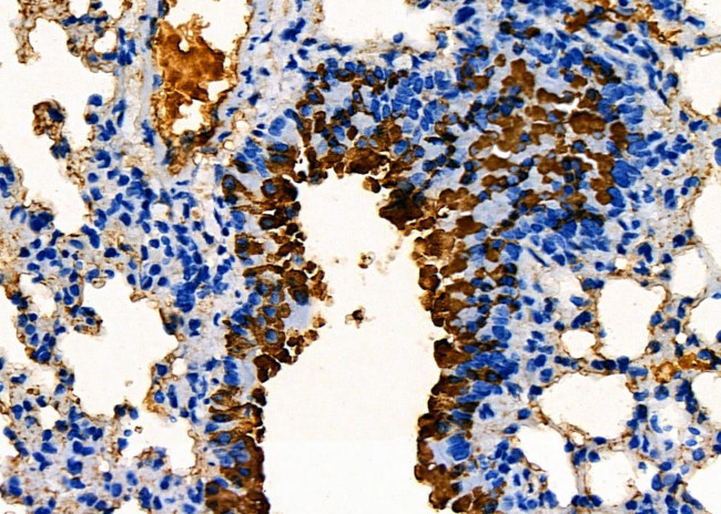 hCG beta-2 Antibody in Immunohistochemistry (Paraffin) (IHC (P))