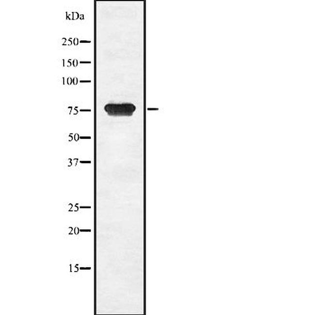 hCG beta-2 Antibody in Western Blot (WB)