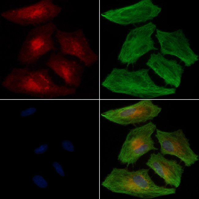 PIP Antibody in Immunocytochemistry (ICC/IF)