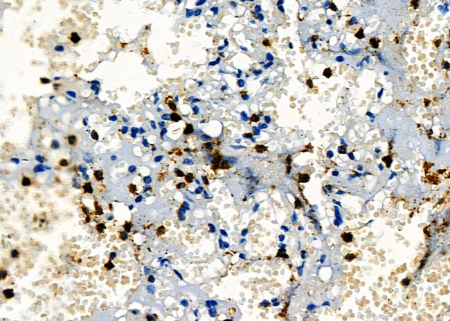 PIP Antibody in Immunohistochemistry (Paraffin) (IHC (P))