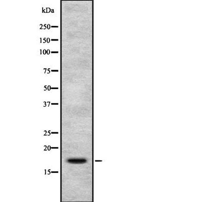 PIP Antibody in Western Blot (WB)