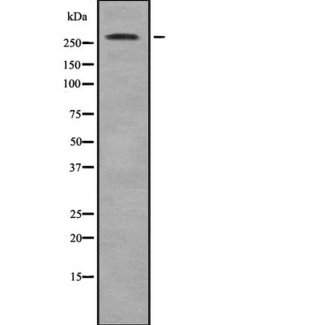 ACACB Antibody in Western Blot (WB)