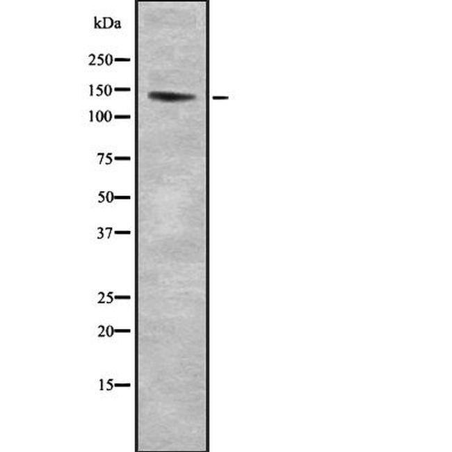 RASGRF1 Antibody in Western Blot (WB)