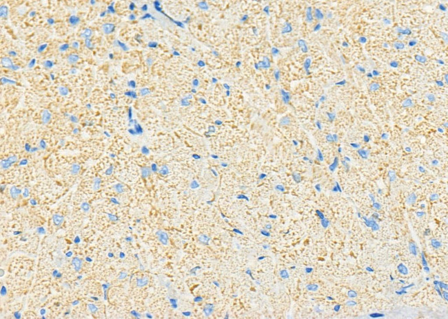 CYP3A5 Antibody in Immunohistochemistry (Paraffin) (IHC (P))