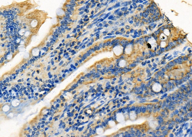 CYP3A5 Antibody in Immunohistochemistry (Paraffin) (IHC (P))