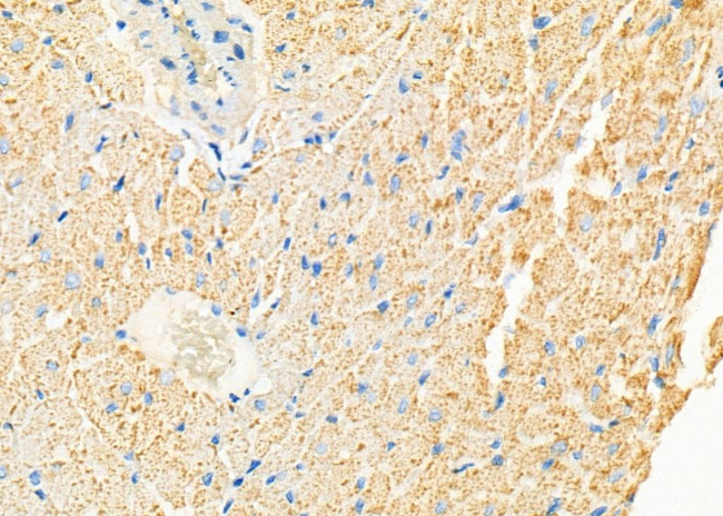 CYP3A5 Antibody in Immunohistochemistry (Paraffin) (IHC (P))