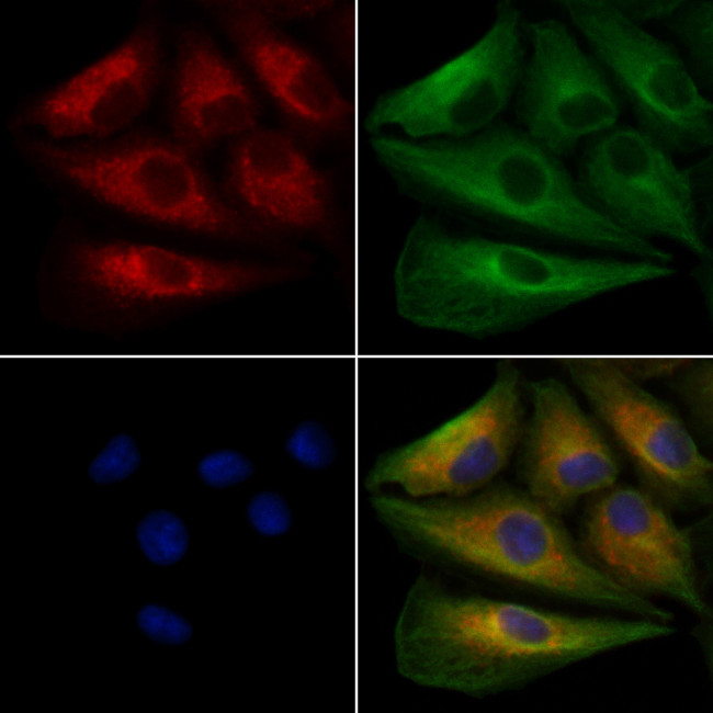 PTP4A2 Antibody in Immunocytochemistry (ICC/IF)