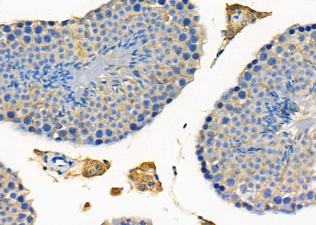 PTP4A2 Antibody in Immunohistochemistry (Paraffin) (IHC (P))