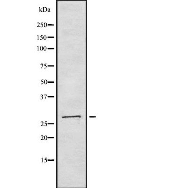 ING4 Antibody in Western Blot (WB)