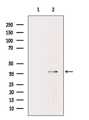 UCH37 Antibody in Western Blot (WB)