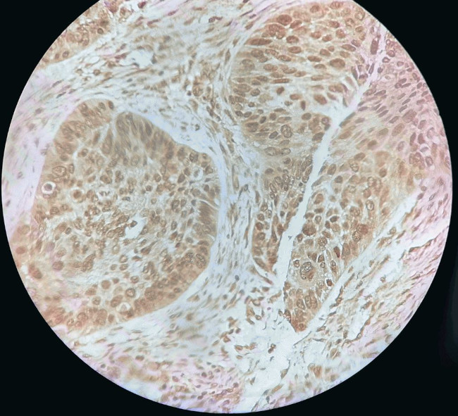 S100P Antibody in Immunohistochemistry (Paraffin) (IHC (P))