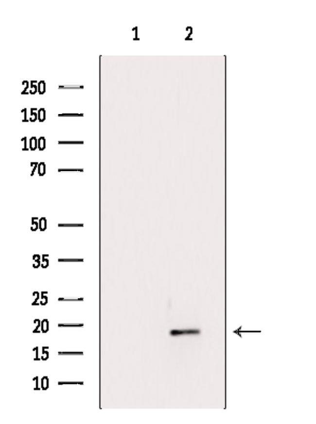 FLAP Antibody in Western Blot (WB)