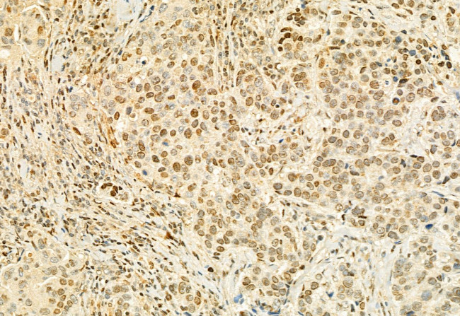 MUC2 Antibody in Immunohistochemistry (Paraffin) (IHC (P))