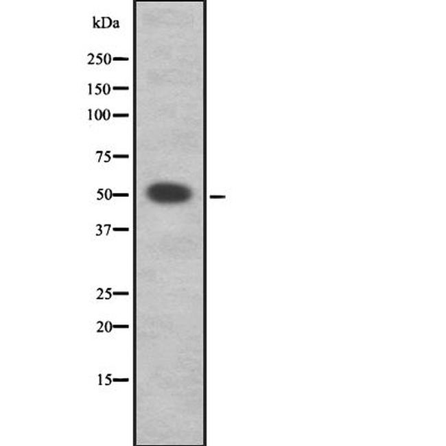 FUS Antibody in Western Blot (WB)