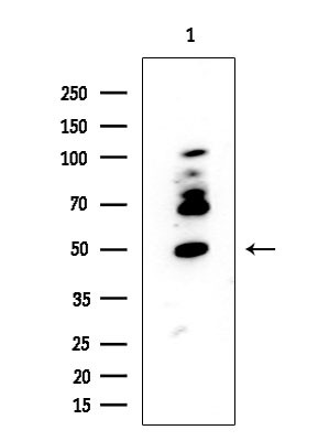 FUS Antibody in Western Blot (WB)