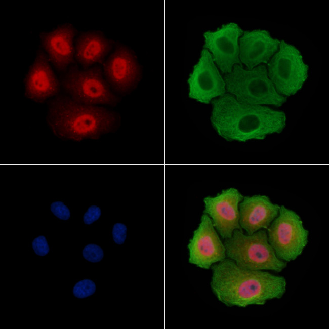 THOC5 Antibody in Immunocytochemistry (ICC/IF)