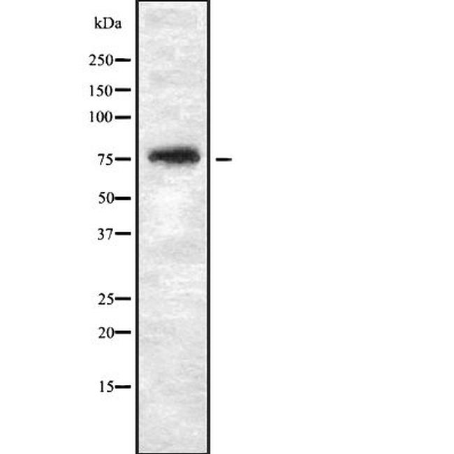 THOC5 Antibody in Western Blot (WB)