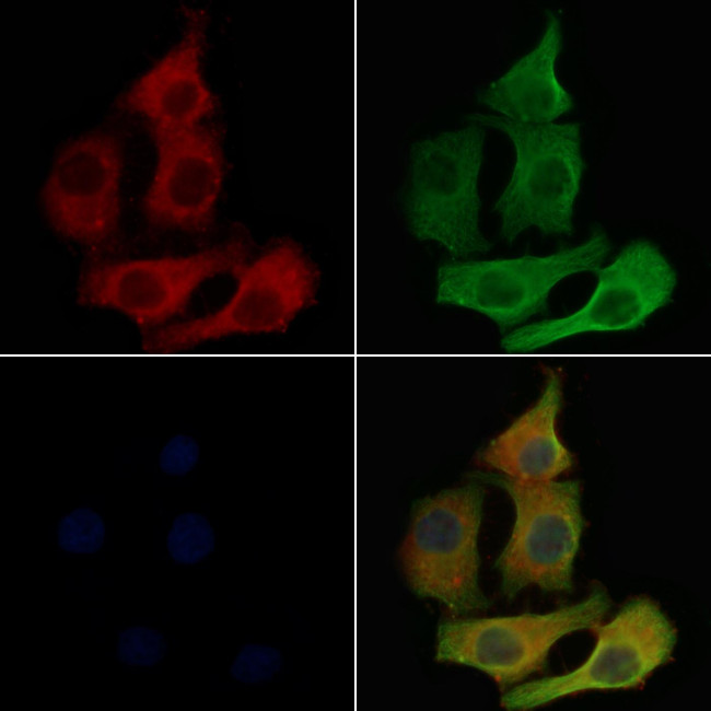 CD179b Antibody in Immunocytochemistry (ICC/IF)