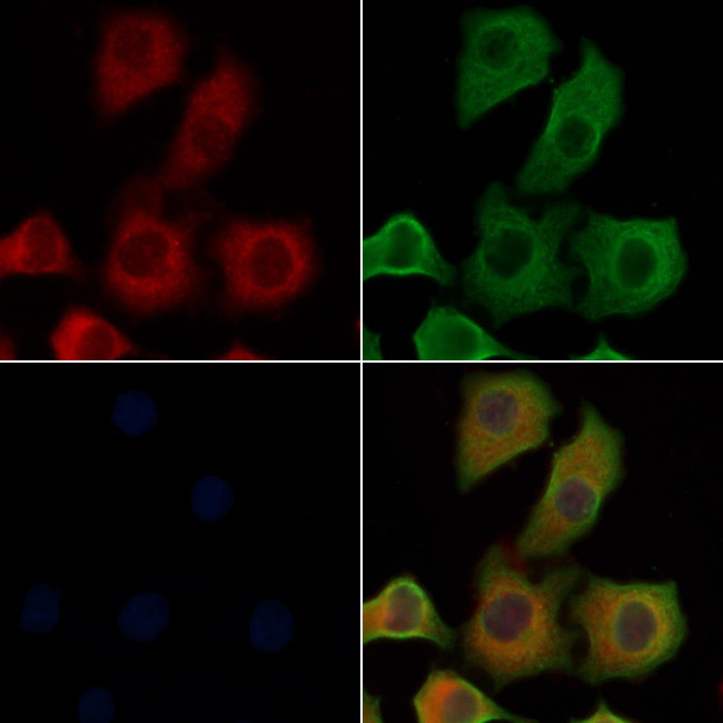 IL4R Antibody in Immunocytochemistry (ICC/IF)