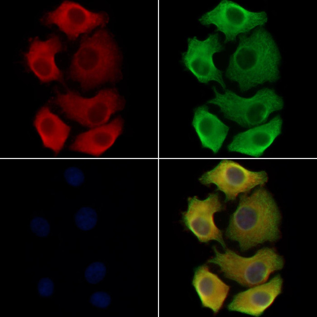 ST3GAL3 Antibody in Immunocytochemistry (ICC/IF)