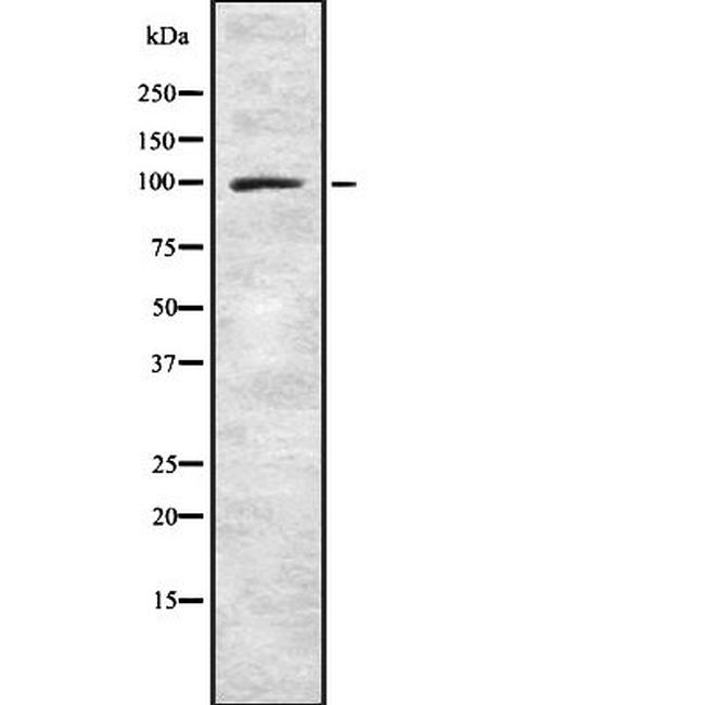 Synphilin 1 Antibody in Western Blot (WB)