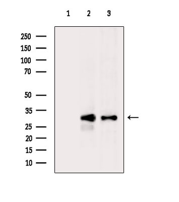 PRSS3 Antibody in Western Blot (WB)