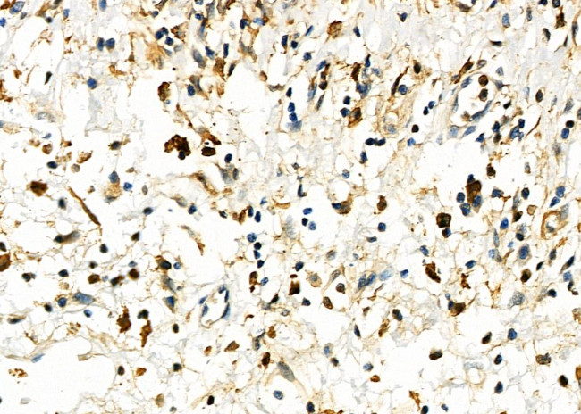 UCP2 Antibody in Immunohistochemistry (Paraffin) (IHC (P))