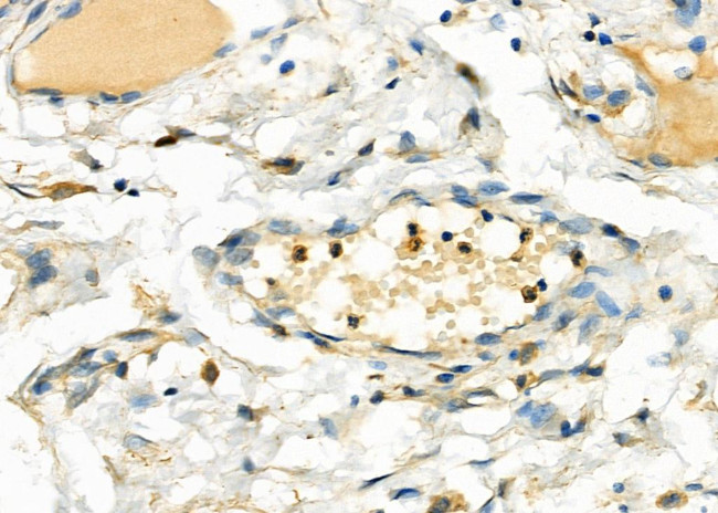 UCP2 Antibody in Immunohistochemistry (Paraffin) (IHC (P))