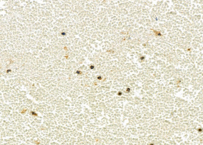 UCP2 Antibody in Immunohistochemistry (Paraffin) (IHC (P))