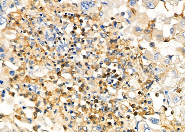 UCP2 Antibody in Immunohistochemistry (Paraffin) (IHC (P))