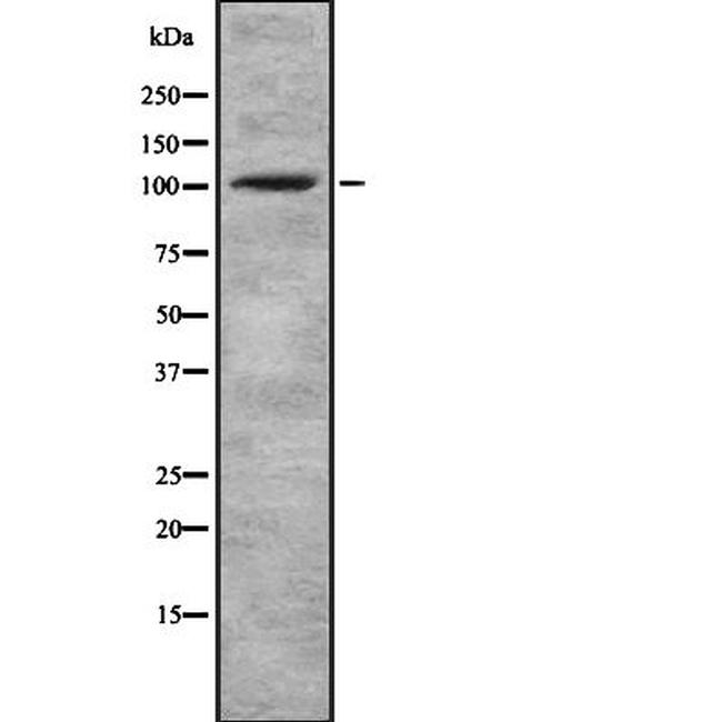 alpha Actinin 1/2/3/4 Antibody in Western Blot (WB)