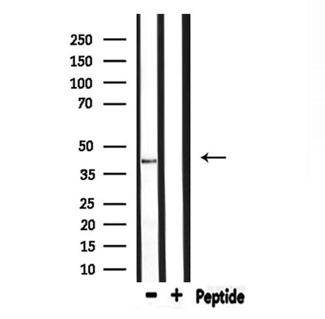 ELAVL2/ELAVL4 Antibody in Western Blot (WB)