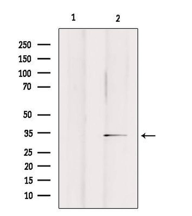 OR2A25 Antibody in Western Blot (WB)