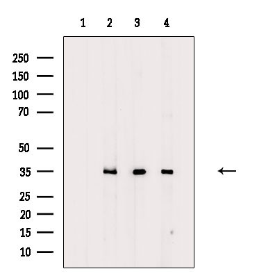 OR2A5/OR2A14 Antibody in Western Blot (WB)