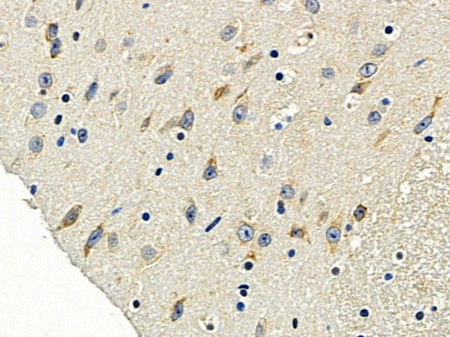 OR5H6 Antibody in Immunohistochemistry (Paraffin) (IHC (P))