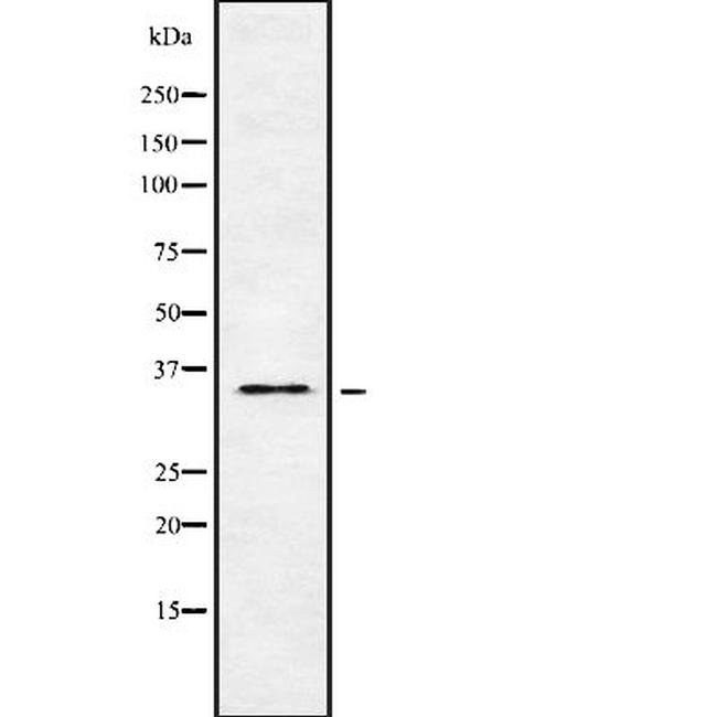 OR5H6 Antibody in Western Blot (WB)